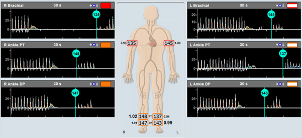 standard ABI test